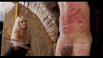 Dolorosos Moretones Rojos En La Carne Del Pobre Tipo XVIDEOS