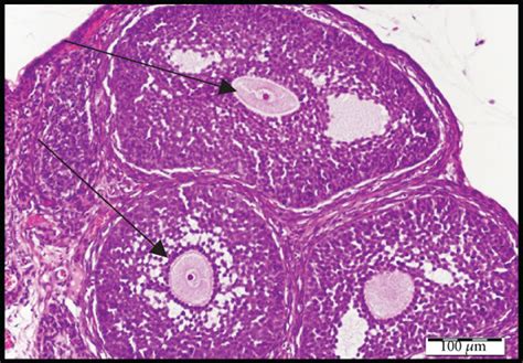 Photomicrographs Of Ovarian Sections Stained With Hematoxylin And