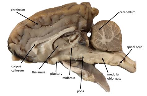 Sheep Brain Diagram Quizlet