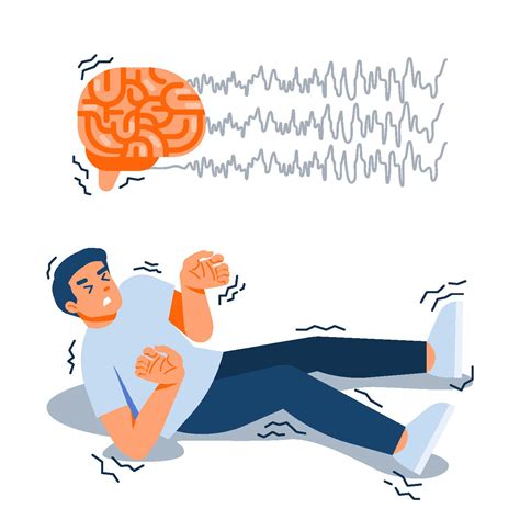 DiagnÓstico E Tratamento Da Epilepsia Dr Renan Barros Domingues