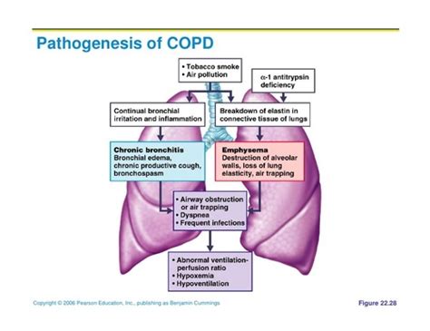 Patho Respiratory Flashcards Quizlet