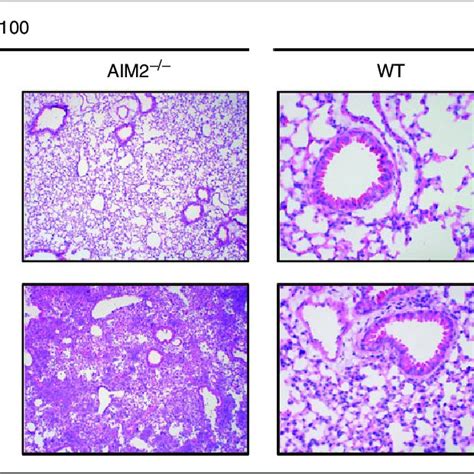 Absent In Melanoma Aim Deficiency Affects Mouse Survival And