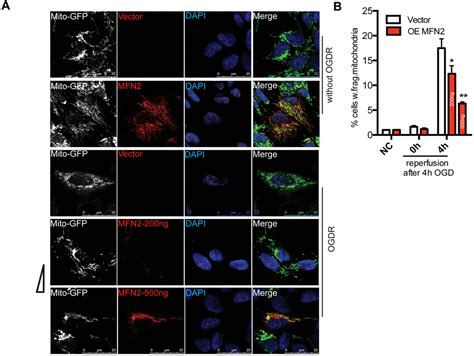 Usp Protects Against Oxygen Glucose Deprivation Reperfusion Induced