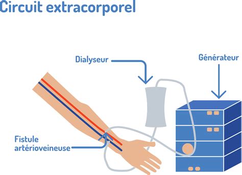 Traitement De Suppl Ance Par Dialyse Aub Sant