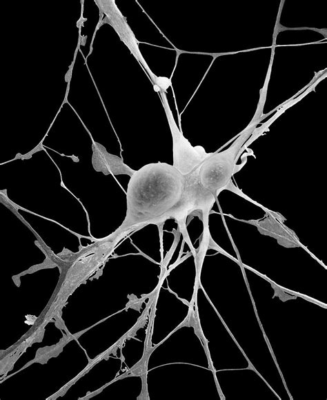 Pyramidal Neurons From Cns Photograph By Dennis Kunkel Microscopy