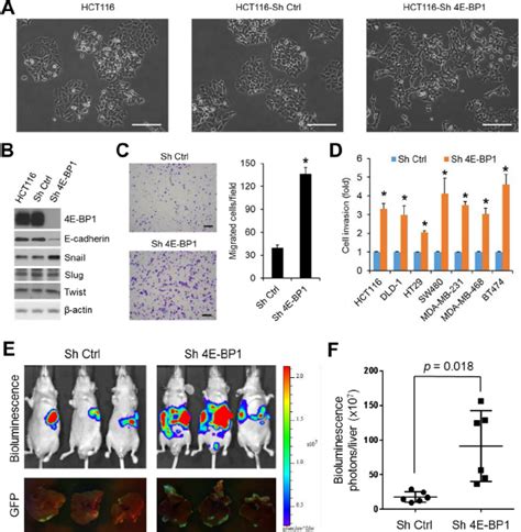 Silencing Of 4e Bp1 Induces Emt Upregulates Snail Expression And Download Scientific Diagram