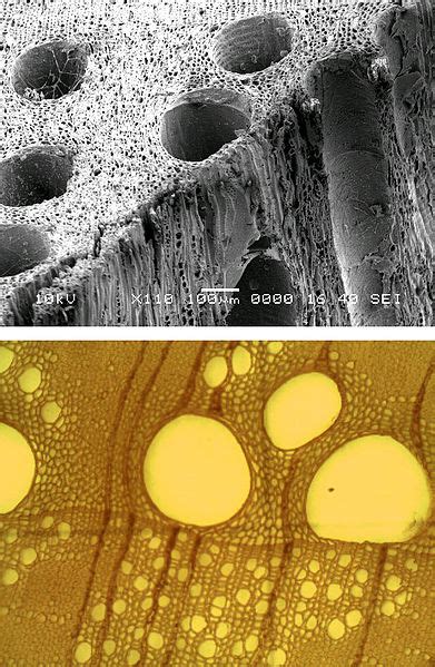 Difference Between Tracheids and Vessels | Definition, Characteristics ...