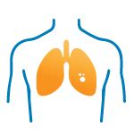 Biopsia Liquida Istituto Diagnostico Varelli Napoli Test