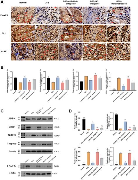 Antagomir Of MiR 31 5p Modulates Macrophage Polarization Via The AMPK