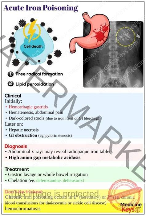 Acute Iron Poisoning Medicine Keys For MRCPs