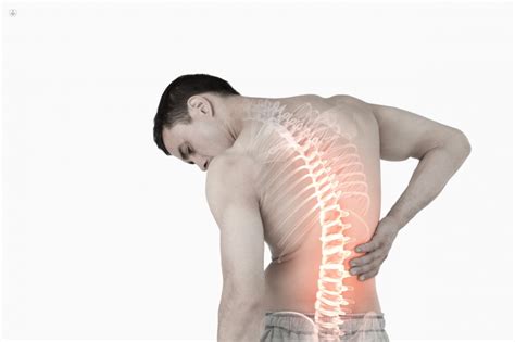 Dolor Lumbar Síntomas Y Tratamiento Top Doctors