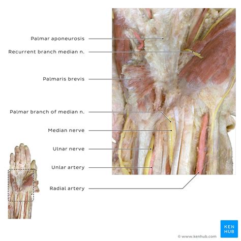 Median Nerve Nervus Medianus Ulnar Nerve Median Nerve Off