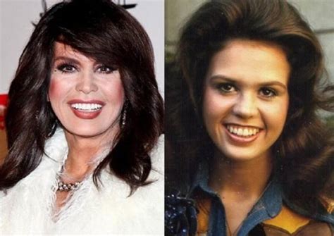 Marie Osmond’s Before and After Photos Show Her Various Facets | Dirty ...