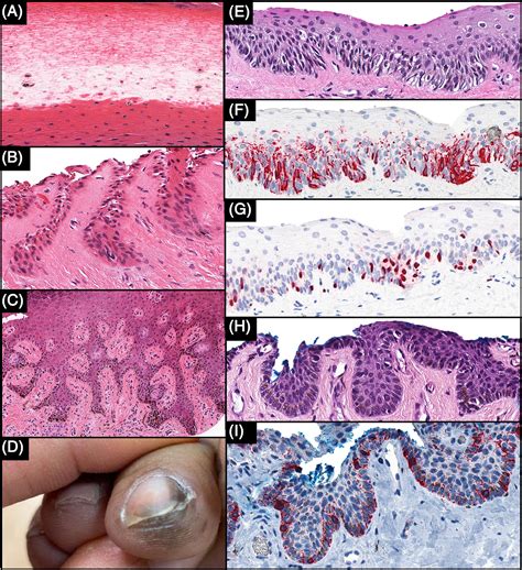 Nail Matrix Histology
