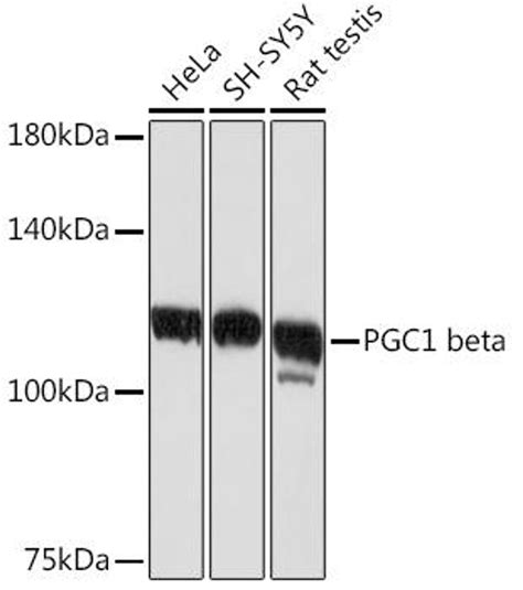 Anti Pgc1 Beta 항체 Assay Genie