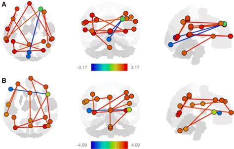 Significant Resting State Fmri Network Connectivity Changes With A