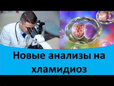 Анализ на хламидии, как проводится, расшифровка результатов