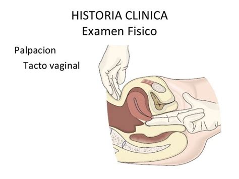 Examen Del Sistema Reproductor Femenino