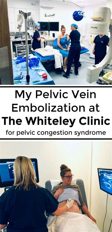 My Pelvic Vein Embolization At The Whiteley Clinic For Pelvic