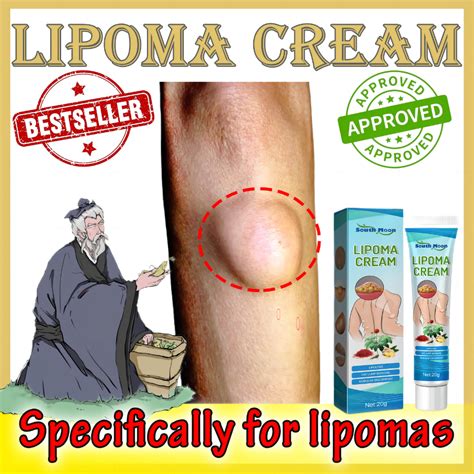 50g Lipoma Cream 20 Bukol Removal Cream Original Bukol Ointment Ginger