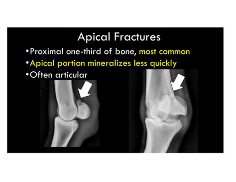 Fetlock joint and metacarpus/tarsus Flashcards | Quizlet