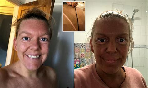 Woman Reveals How Her Pre Wedding Fake Tan Went Very Wrong Daily