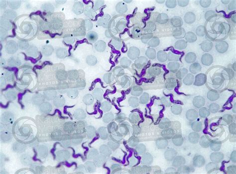 Trypanosoma Sp Trypanosomiasis 1000x Protozoa Protozoa Endoparasites Parasitology Photos