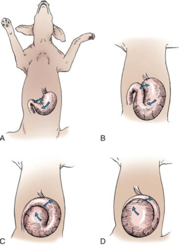 Surgical Diseases Of The Gastrointestinal Tract Flashcards Quizlet