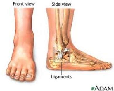 Weak Ankles - Assignment Point