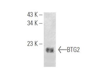 BTG2抗体 E 4 SCBT Santa Cruz Biotechnology