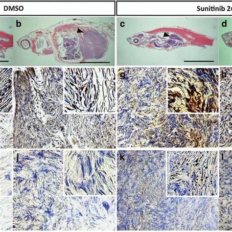 Sunitinib Promotes Apoptosis Of Primary Mpnst Progression In Transgenic