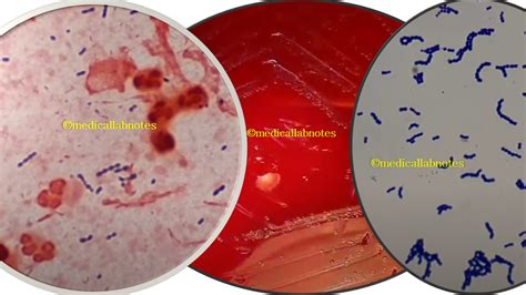 and Viridans streptococci in Gram staining of culture (right) Archives - Medical Notes