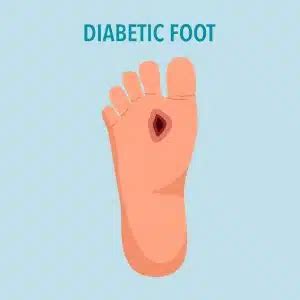 Diabetic Foot Pain Archives - Advanced Bone & Joint