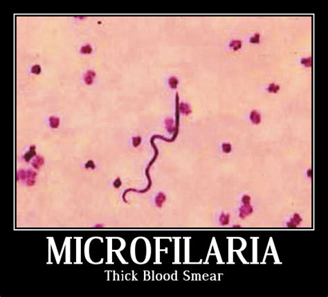 Microfilaria | Ask Hematologist | Understand Hematology