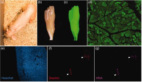 Interspecies Chimeras As A Platform For Exogenic Organ Production And