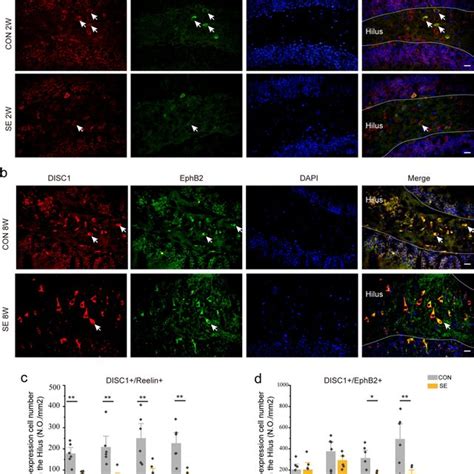 The Co Expression Of DISC1 And Reelin DISC1 And EphB2 In The Hilus