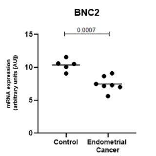 BNC2 Is Expressed At Significantly Lower Levels In The Endometrial