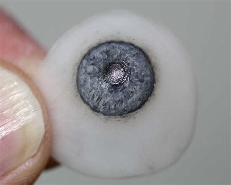 Scleral Shells New Zealand Prosthetic Eye Service