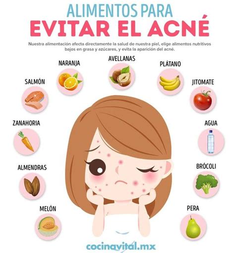 Consejos Para Evitar El Acné