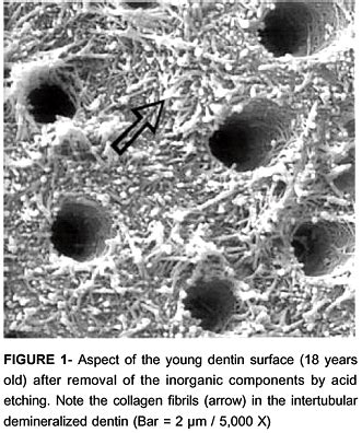 Public health: Teeth under a Microscope-Enamel