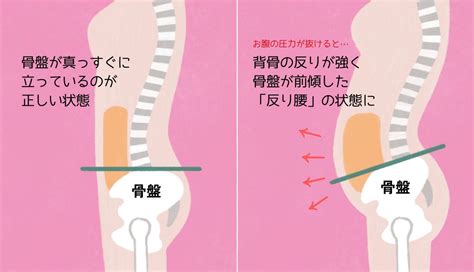 【ぽっこりお腹／腰痛】反り腰を直すのが近道！ 骨盤を正しい位置に戻す呼吸で悩みを改善！【動画あり】 3