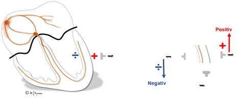 Index Of Elaring Fag Hjertesykdommer Spl Ekg Del Images