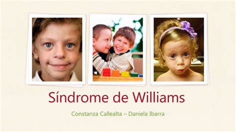 Síndrome De Williams Ppt