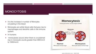 Monocytosis | PPT