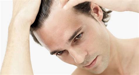 How To Prevent Men Hair Loss Guide By Experthairtransplant Expert Hair Transplant