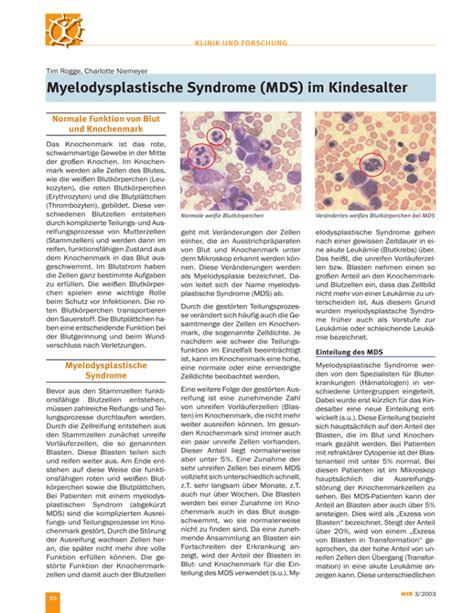 Myelodysplastische Syndrome Mds Im