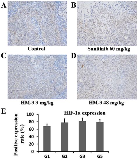 In Vitro And In Vivo Activities Of An Antitumor Peptide Hm 3 A Special