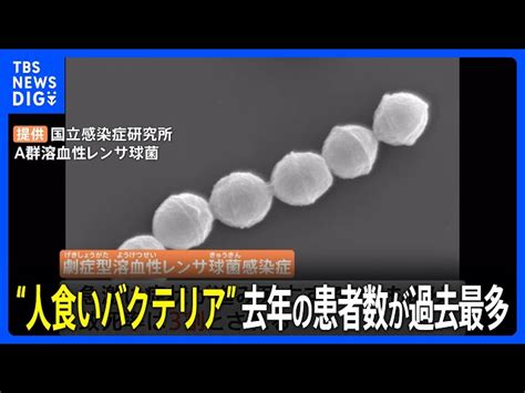 【感染症】致死率3割 “人食いバクテリア”の患者が過去最多 「劇症型溶血性レンサ球菌感染症」 ねことダンボール