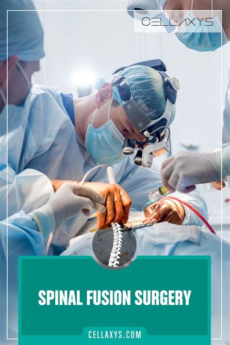 Spinal Fusion Surgery | Spinal fusion surgery, Spinal fusion, Spinal ...