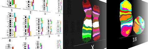 XCyting FISH Probes for Better FISH Results | MetaSystems Probes